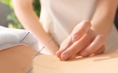 Unlocking Wellness: The Benefits of Acupuncture for a Healthy Lifestyle